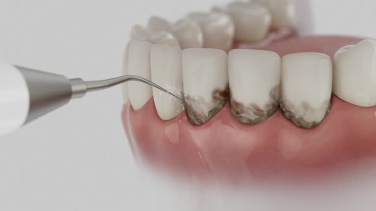 Reliable Emergency Dentist contractor in Flandreau, SD by Smile Center Dentistry